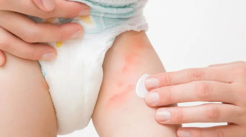 央視點名 這種藥品長期用危害大,別隨便給寶寶用 你家可能就有